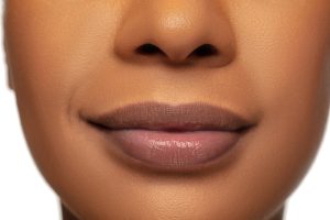 Natural Lip Filler